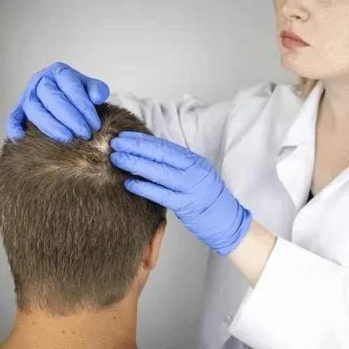 Scalp and hair loss assessment at Glamorous Clinic, Umm Suqeim, Dubai